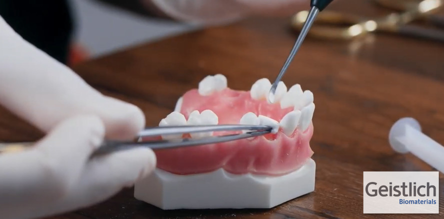 Interaktives Online-Webinar „Alveolenmanagement“