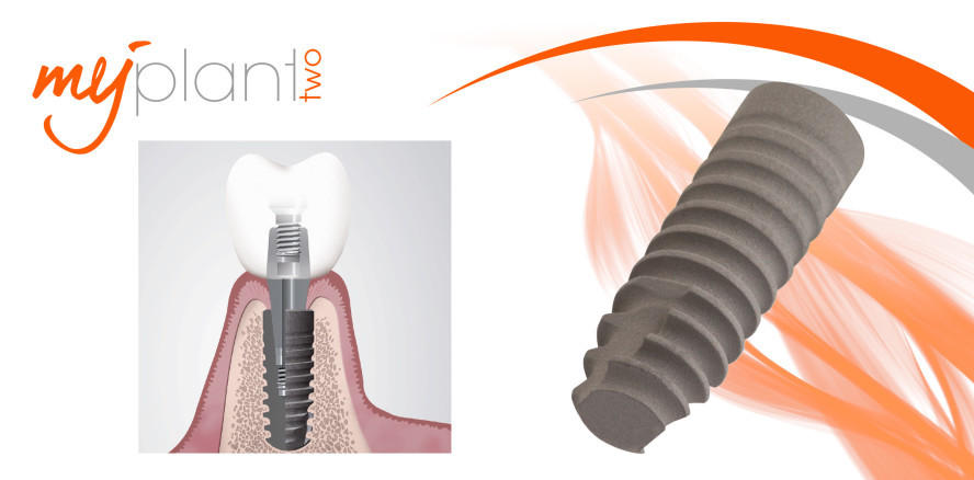 MyPlant II: Herausragendes Implantatsystem