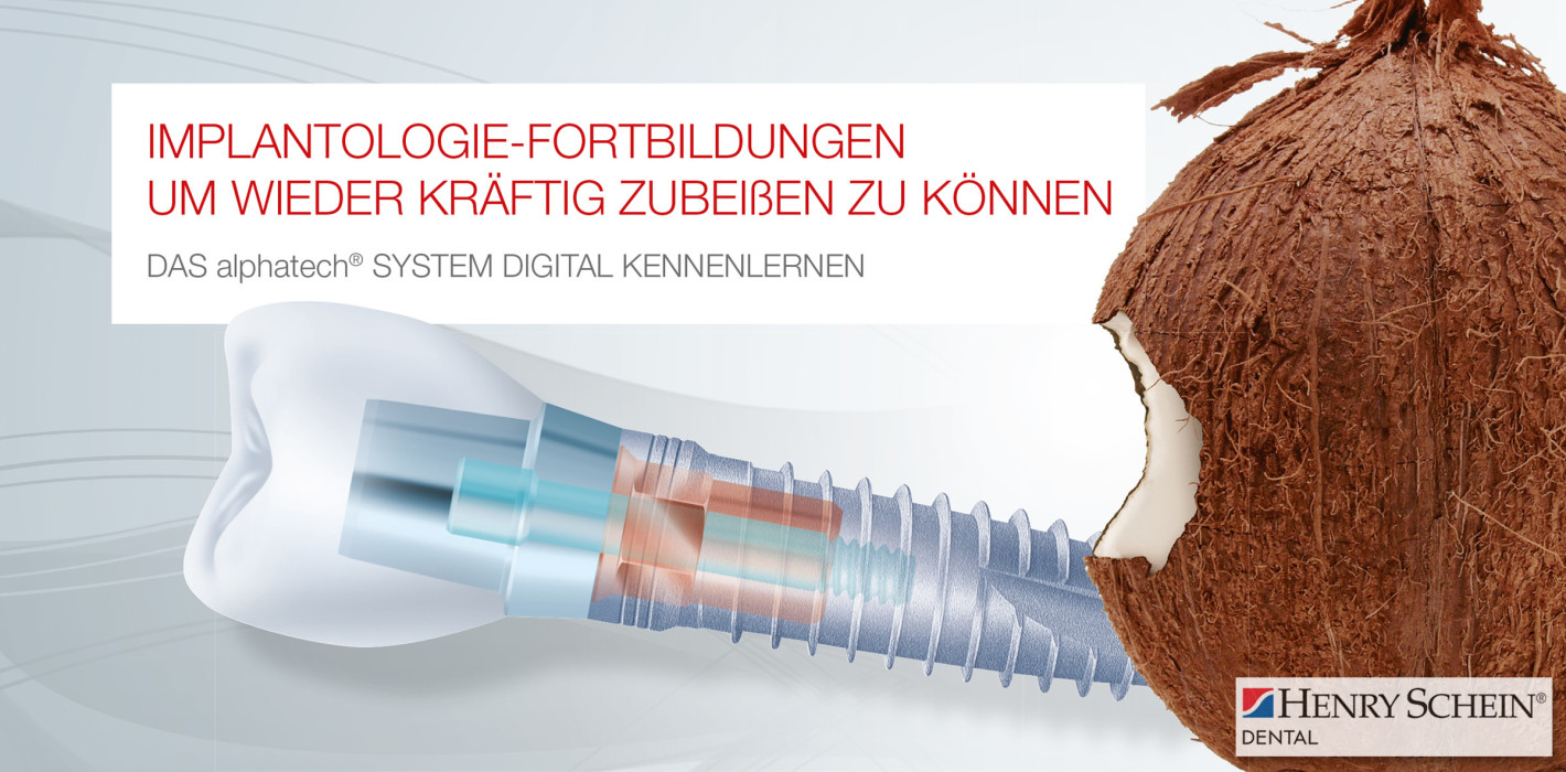 Henry Schein startet implantologischen Online-Informationsaustausch