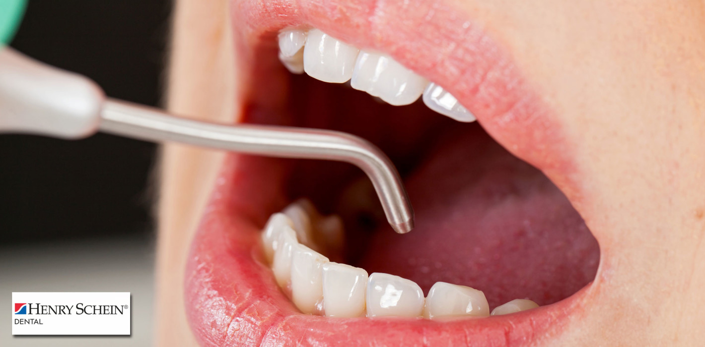 Profitable Prophylaxe – Was ist wirklich zu beachten?
