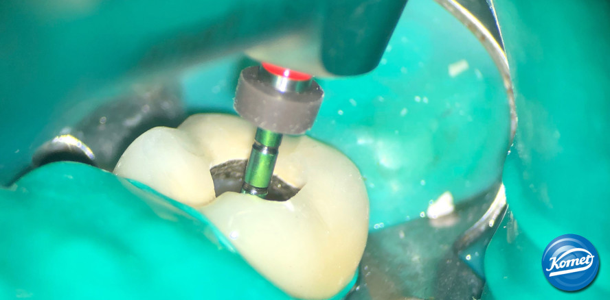 Zuverlässiges reziprokes System für Allrounder und Spezialisten