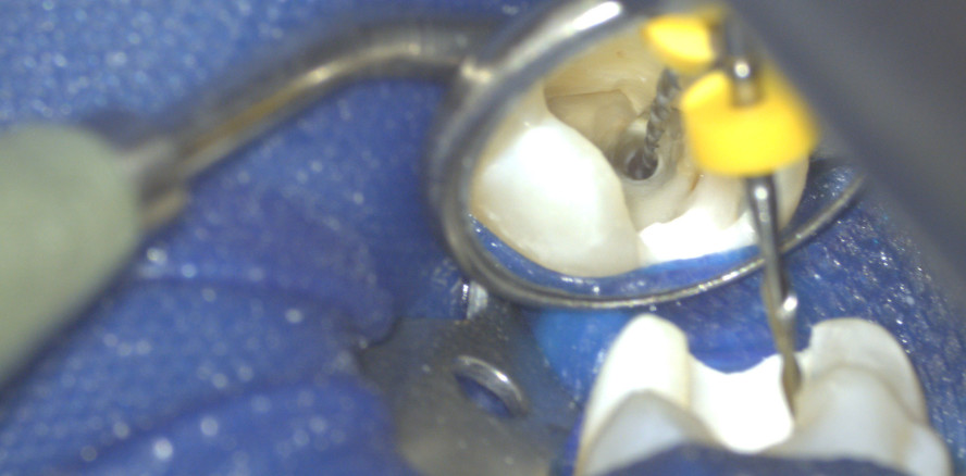 Spezialwissen rund um das richtige Instrumentieren