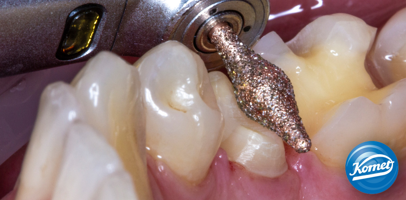 Generation DIAO: Diamantinstrumente neu gedacht