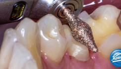 Generation DIAO: Diamantinstrumente neu gedacht