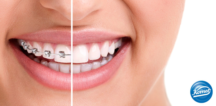 Ein besonderer Teamplayer für die Klebstoffentfernung