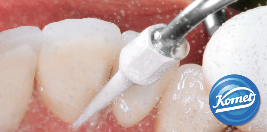 Oberflächendebridement mit kompatiblen Scaler- und Parospitzen