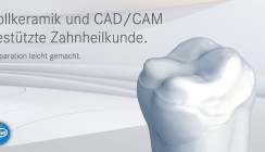 Themenwelt für Vollkeramik & CAD/CAM