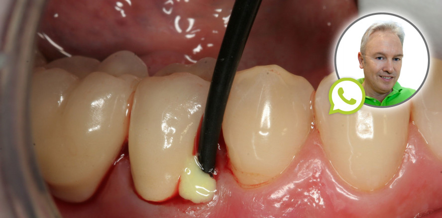 Neue Antworten vom Experten: ASK DOC PARO!