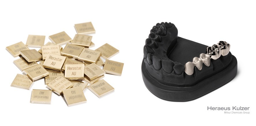 Heraeus Kulzer: Wirtschaftliche Ecolegierung Herastar AU