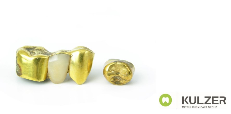 Kulzer erhöht Altgold-Spenden durch Verzicht auf Scheidekosten