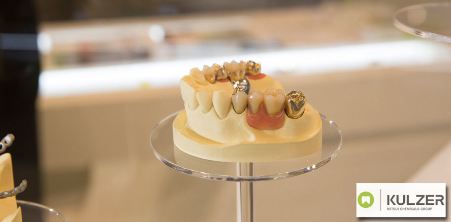 Altes Gold in Geld verwandeln