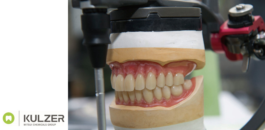 Prothetik mit System