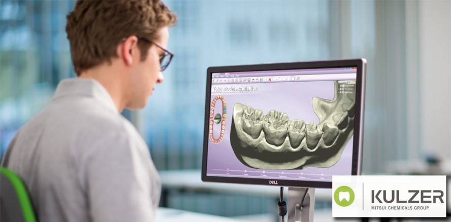 Kulzer: Webinar-Reihe zu CAD-Konstruktionssoftware