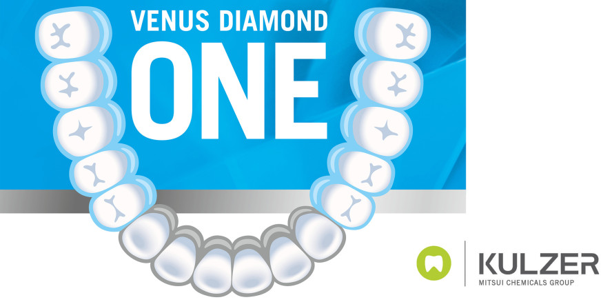 FAQs: Was macht bei Venus® Diamond ONE den Unterschied?