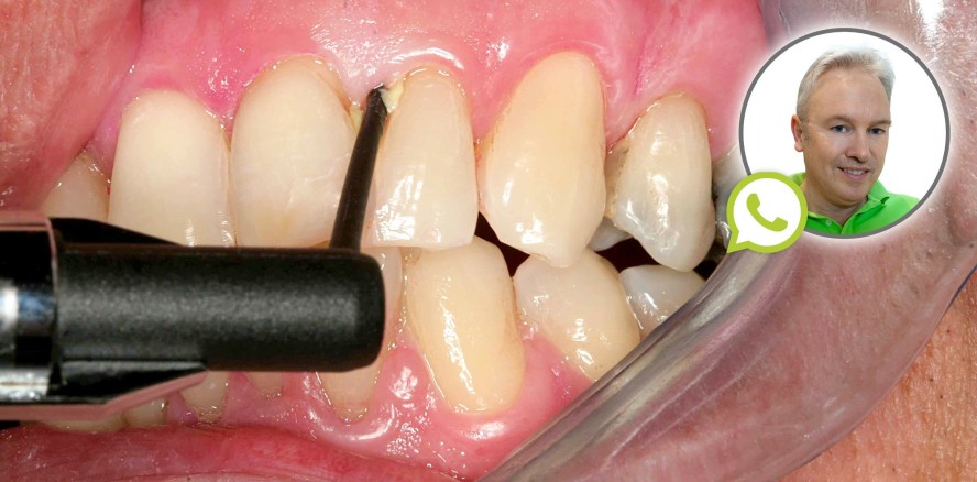 Sie fragen, der Experte antwortet: ASK DOC PARO!