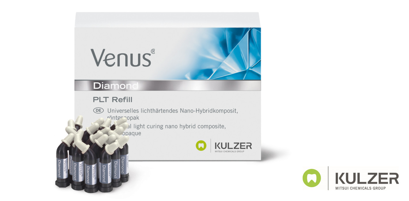 Warum Venus® Diamond ONE? Vier Fragen und Antworten