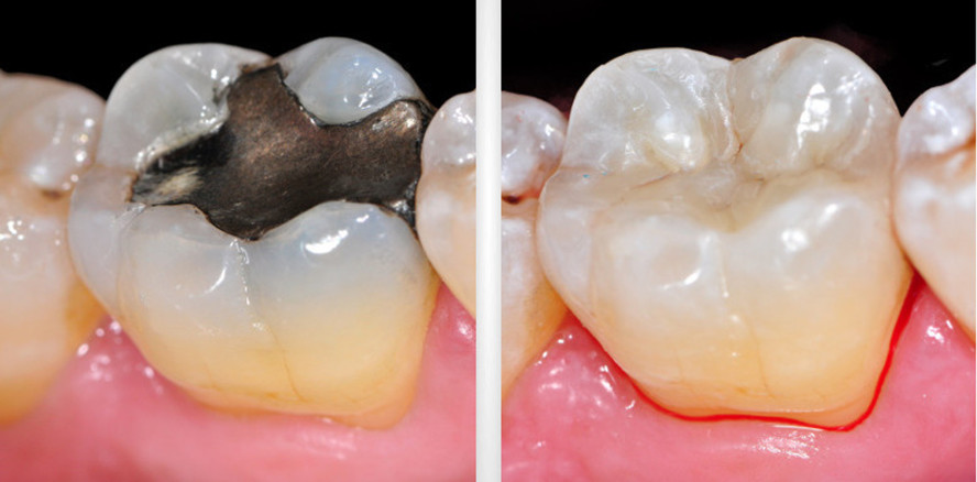Webinar „Chromoadaptive Kompositmaterialien“