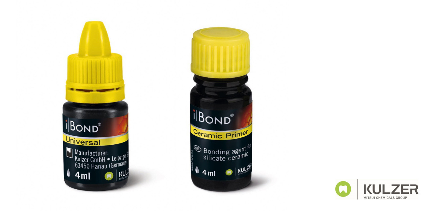 iBOND® Universal – die Idealbesetzung für intraorale Reparaturen