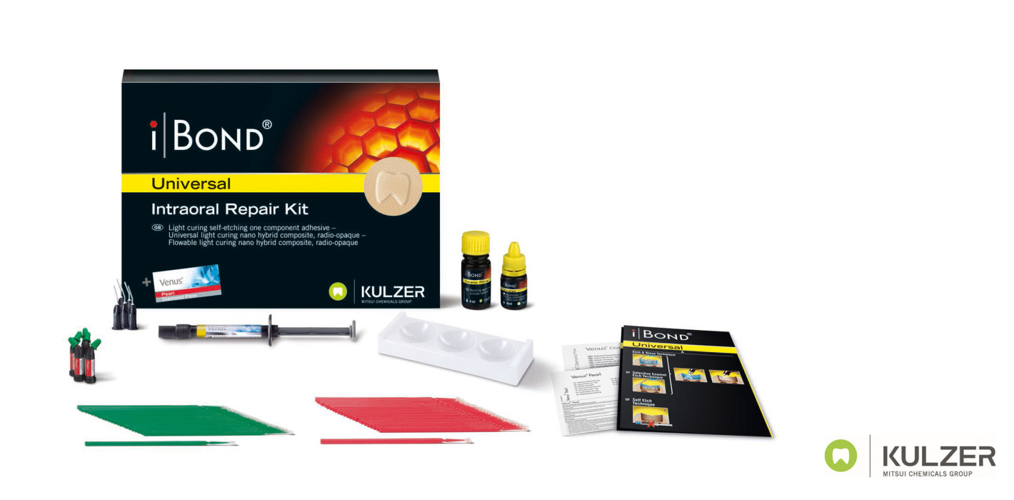 iBOND© Universal – perfekt gerüstet für intraorale Reparaturen