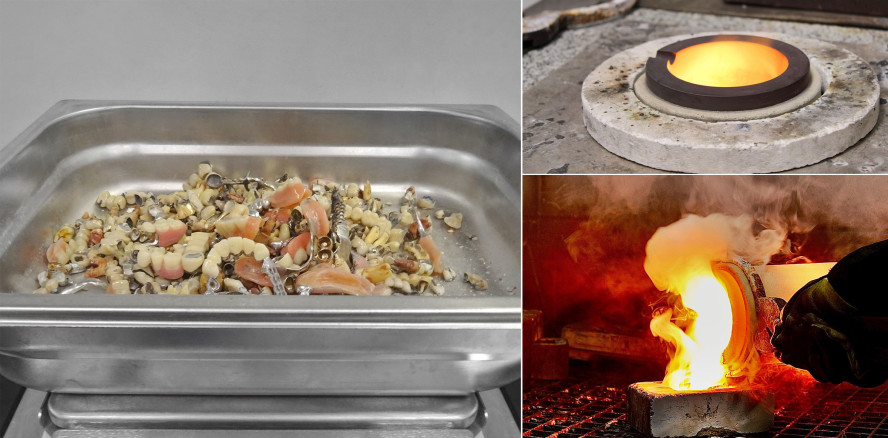 Zahngold-Recycling – verantwortungsvoll und rechtssicher