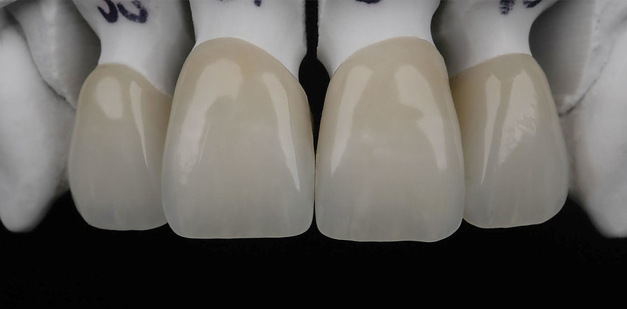 Innere Werte zählen: Internal Stain als Herzstück im Micro-Layering