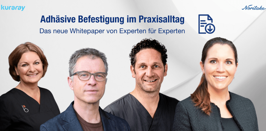 Neues Whitepaper: Adhäsive Befestigung indirekter Restaurationen