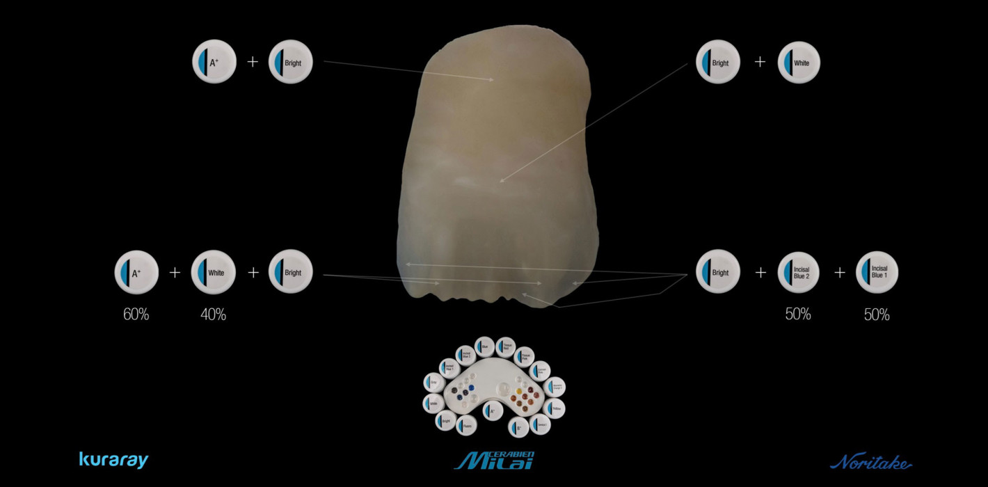 Internal Stain: CERABIEN™ MiLai macht Micro-Layering zur Königsdisziplin