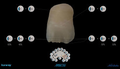 Internal Stain: CERABIEN™ MiLai macht Micro-Layering zur Königsdisziplin