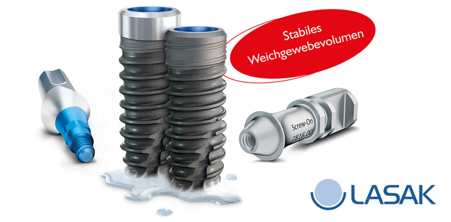 LASAK: Neue 3-jährige klinische Studie zu BioniQ Implantaten