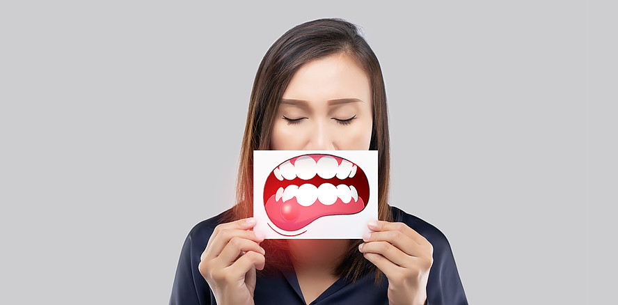 Webinar zum World Oral Health Day: Parodontale Gesundheit muss priorisiert werden