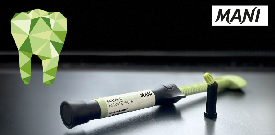 Neues Bis-GMA freies Komposit „ManiFill Hybrid Ease“ im Praxistest