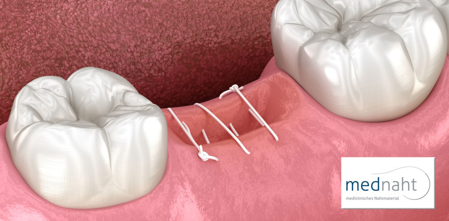 Grundregeln & Tipps zum dentalchirurgischen Nähen