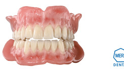 Wissen auffrischen – Skills Loading von Merz Dental