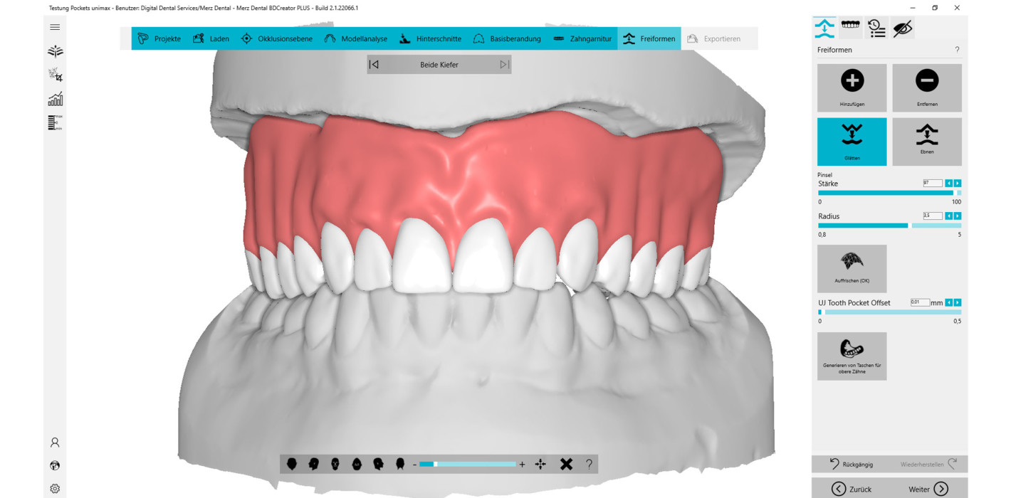 Simplify your (Full)Denture – vereinfacht die CAD-Konstruktion von Totalprothesen