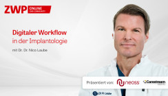 Digitaler Workflow in der Implantologie