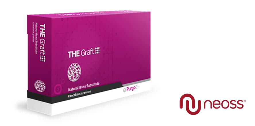 Neues Produkt: THE Graft™ jetzt bei Neoss®