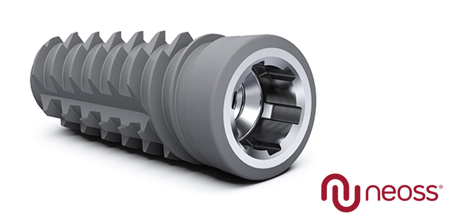 Mit Neoss ProActive® Edge Implantaten zu hervorragender Primärstabilität