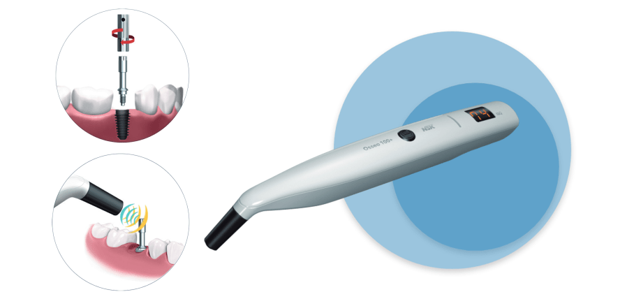 Auf den Punkt genau messbare Osseointegration