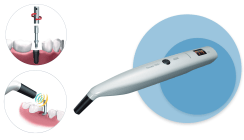 Auf den Punkt genau messbare Osseointegration
