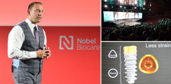 Game Changer? – Nobel Biocare stellt neues Implantatsystem vor