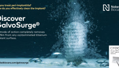 GalvoSurge® Dentalimplantat-Reinigungssystem mit neuer Technologie