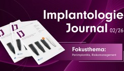 IJ 2/26: Periimplantitis und Risikomanagement im Fokus