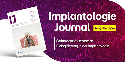 Jetzt im IJ 5/26: Biologisierung in der Implantologie