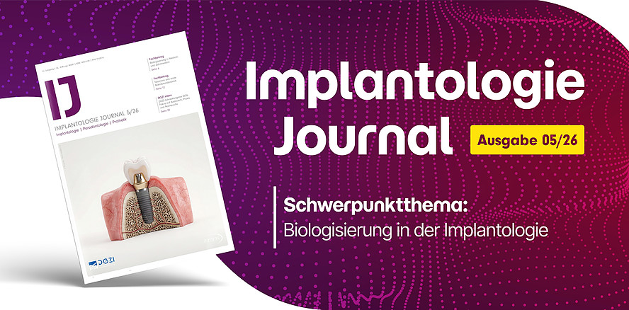Jetzt im IJ 5/26: Biologisierung in der Implantologie