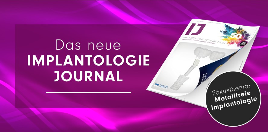 Sommerausgabe des IJ: Metallfreie Implantologie im Fokus