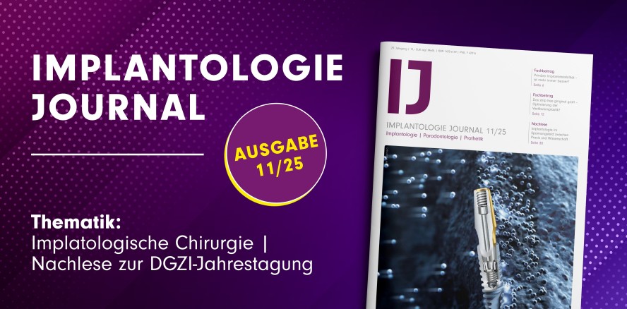 Konzepte der implantologischen Chirurgie im aktuellen IJ 11/25 vorgestellt