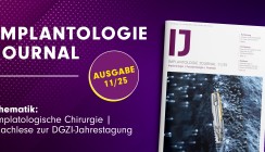 Konzepte der implantologischen Chirurgie im neuen IJ 11/25