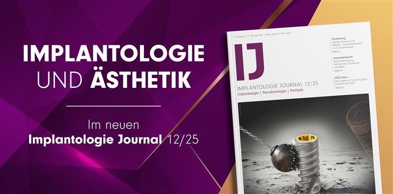 Jetzt online lesen: Ästhetische Konzepte im Implantologie Journal 12/25