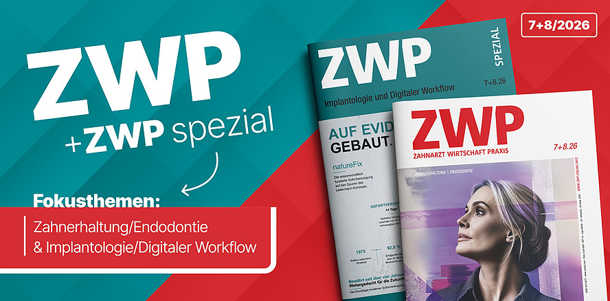 Zahnerhaltung & Endo im Fokus: Die August-Ausgabe der ZWP ist da
