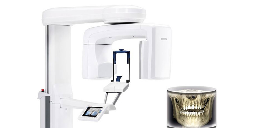 Premium-3D-Bildgebung für Zahnarztpraxen